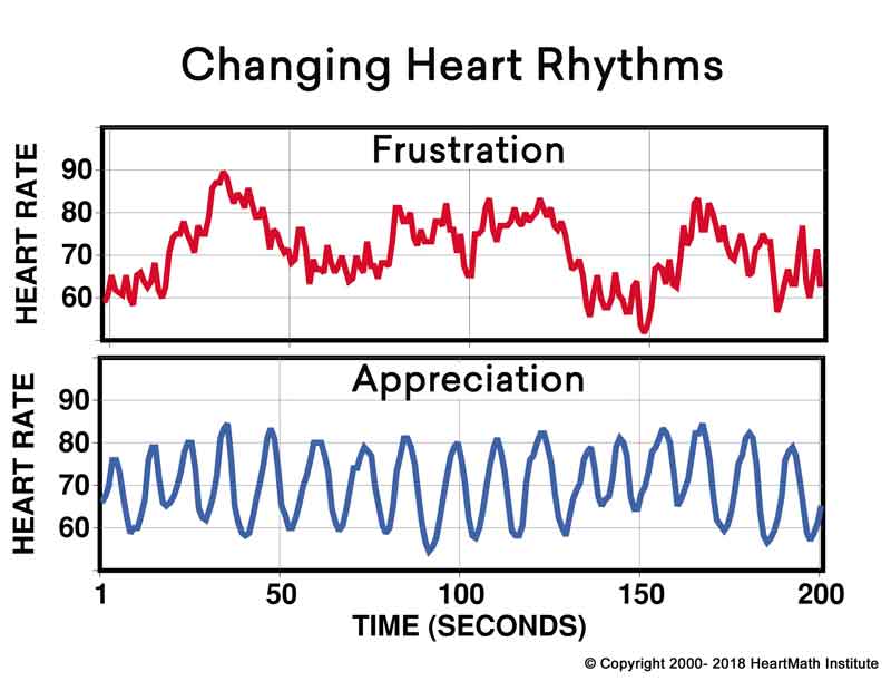 sleep-graph