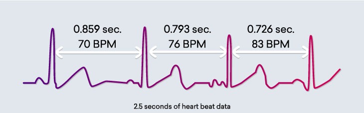 HRV Graph